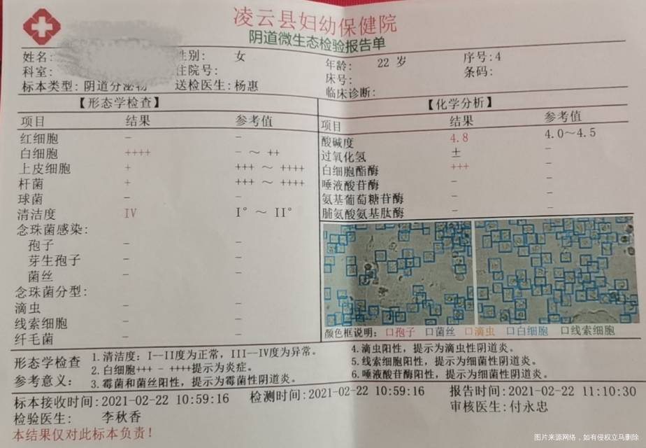 医生你好我这个白带常规检查从2020年10月