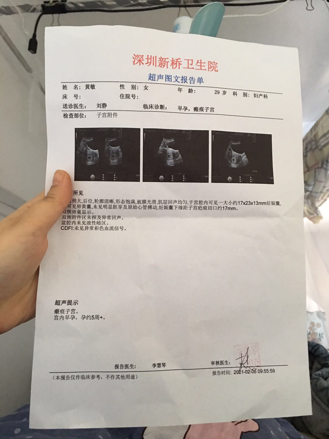 和停经天数不符末次月经12月20日