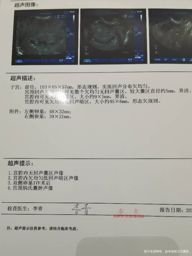医生请问我试管婴儿鲜胚移植第29天B超是什么
