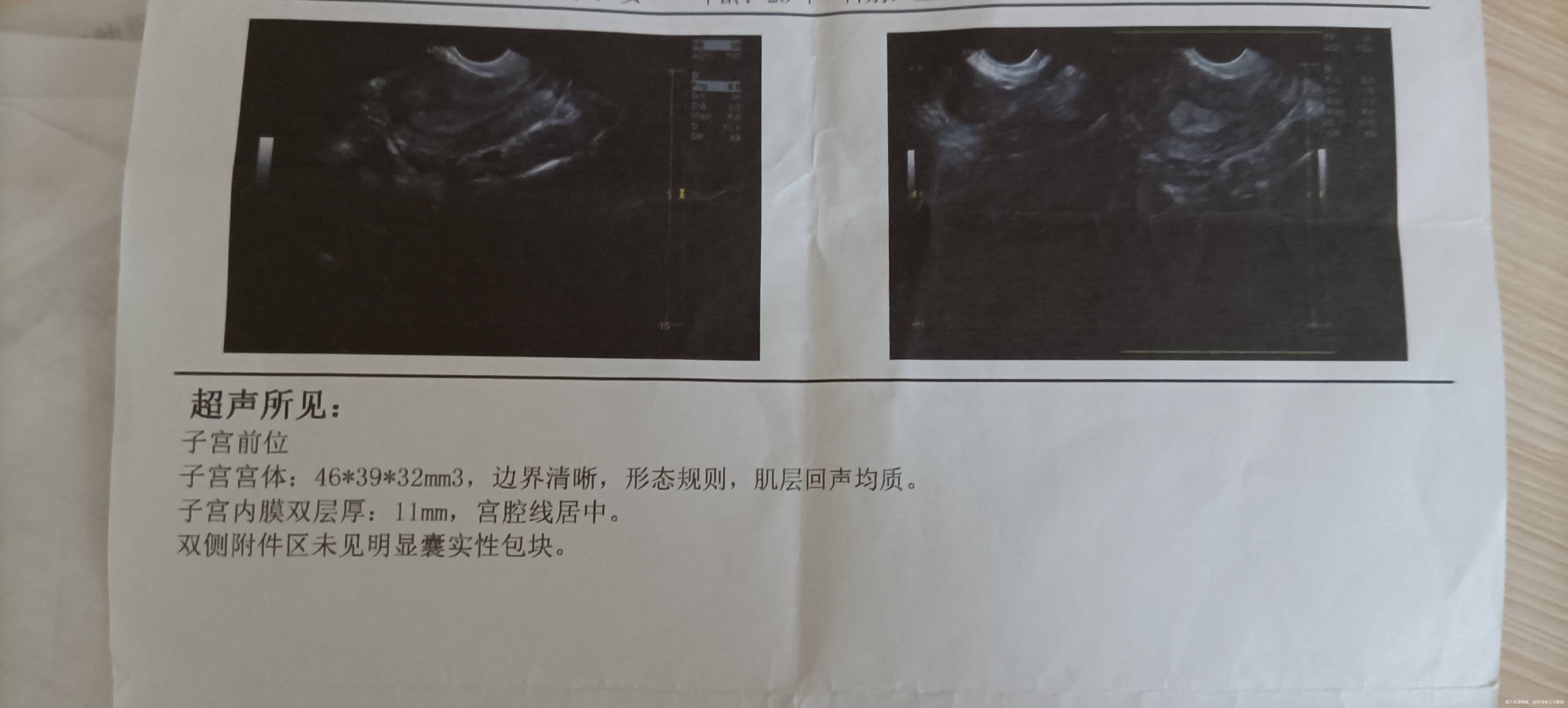 2019年9月份做了一次b超第一张图是在月经
