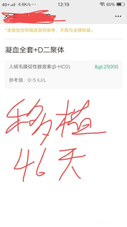 你好麻烦你帮我看一下我这两个单子的单位是一样