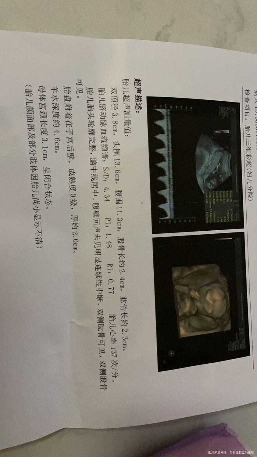 17+3的我做完彩超测得中唐这结果有什么边缘