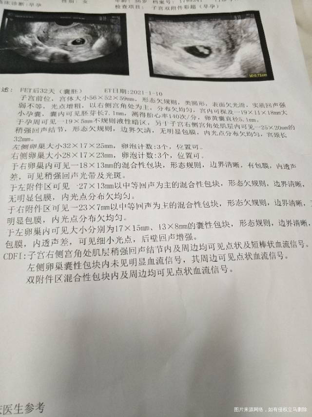 麻烦医生帮我看一下我的这个B超单子问题大吗