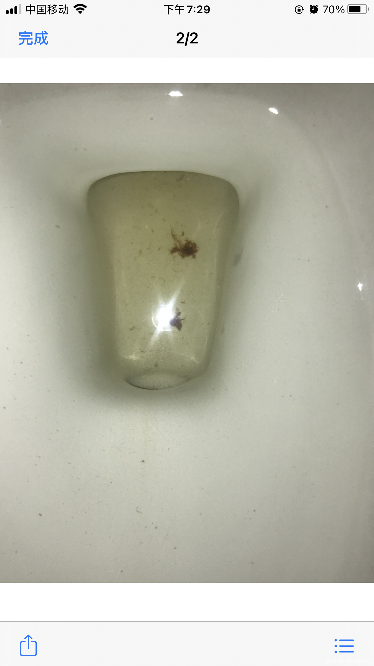 孕38+在医院取分泌物检查取完分泌物后当天出