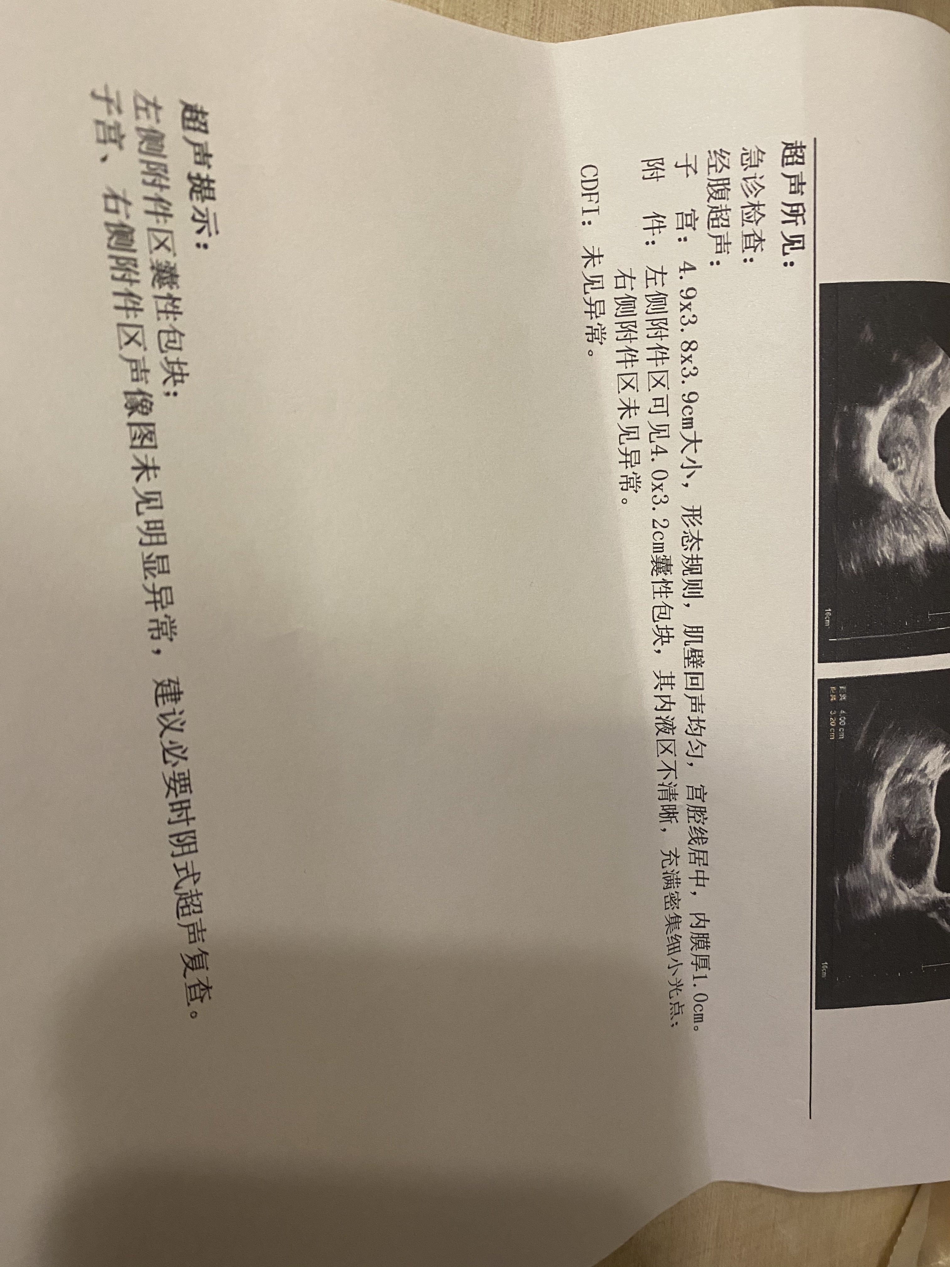 这是我12月20号做的b超2月2号月经第二天