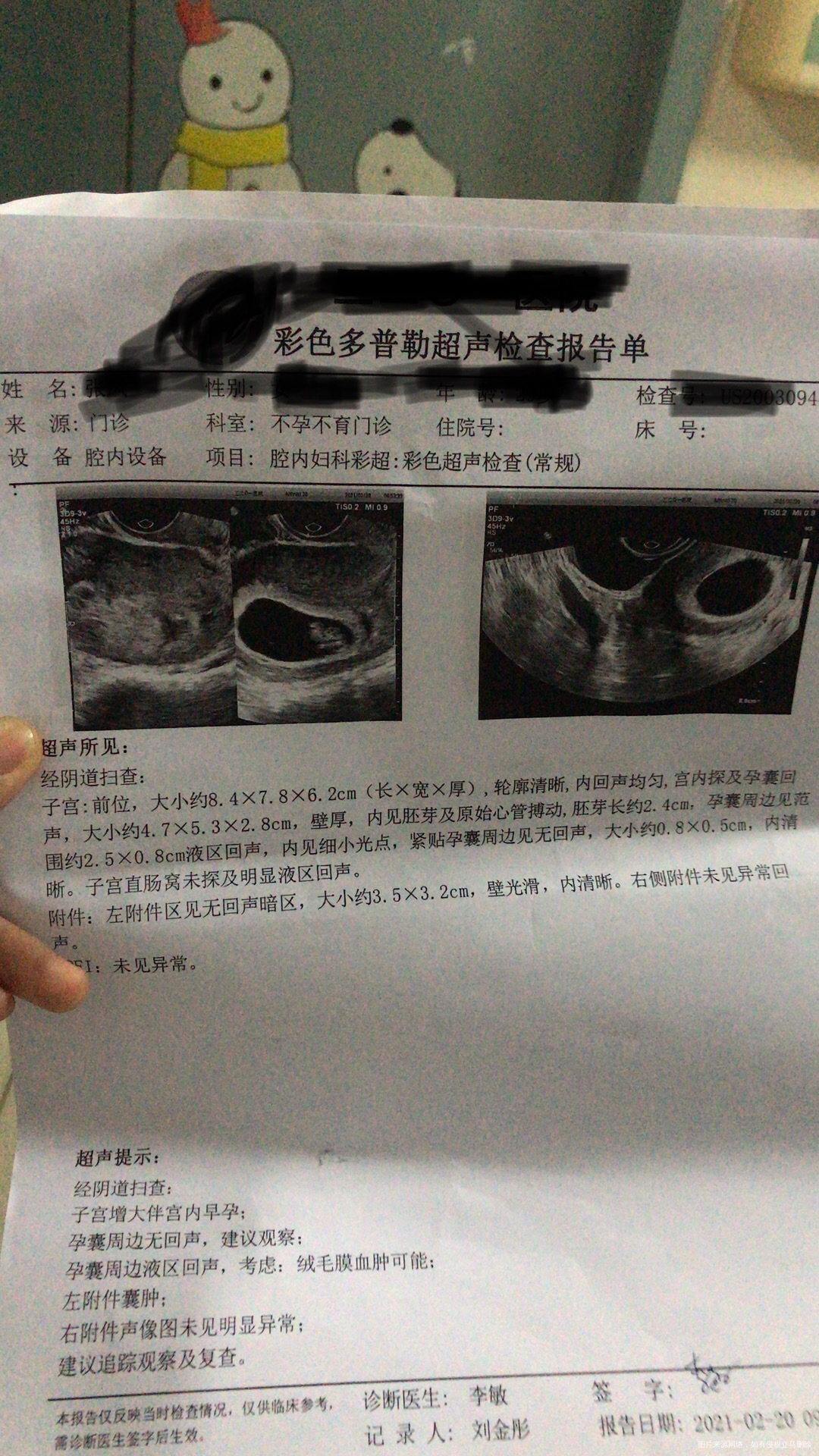 当天做的HCG103656孕酮大于40雌二醇