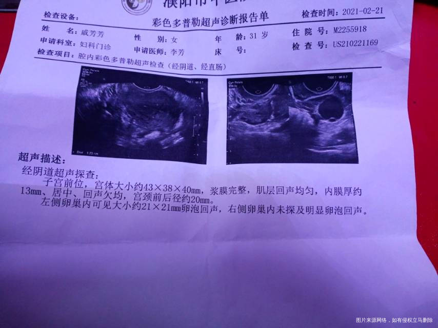 医生您好我现在在监测卵泡备孕想请您看下阴超单