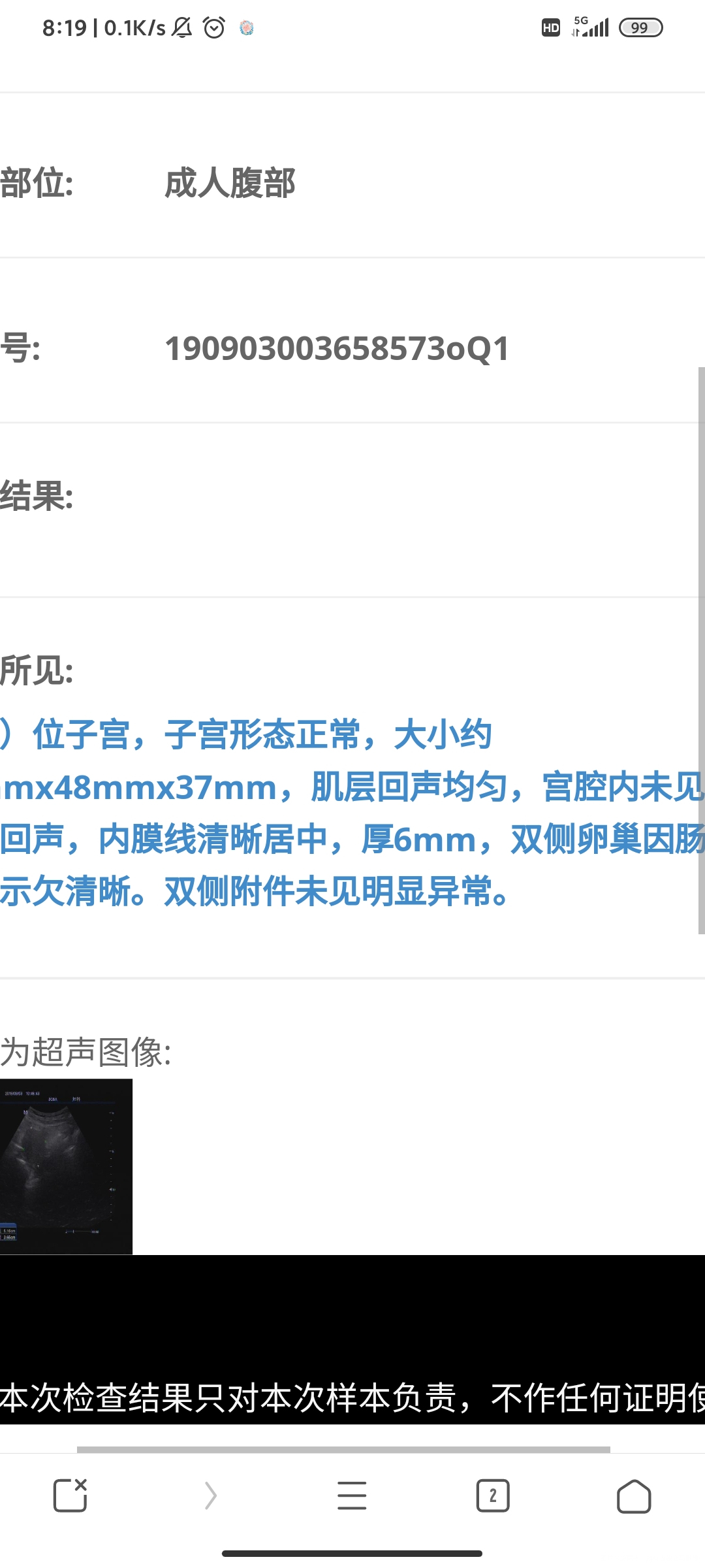 2019年9月份做了一次b超第一张图是在月经