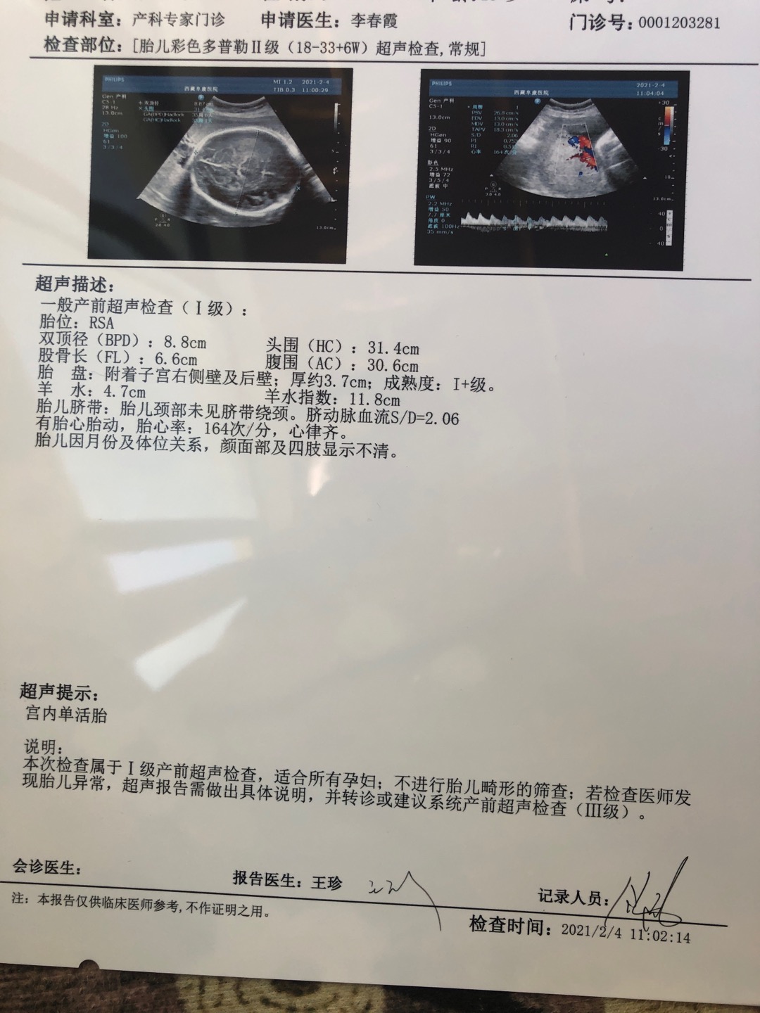 医生给你好想咨询下末次月经是525号停的但是