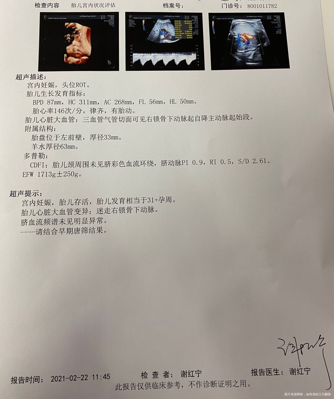 30周的B超显示有迷走右锁骨下动脉请问接下来