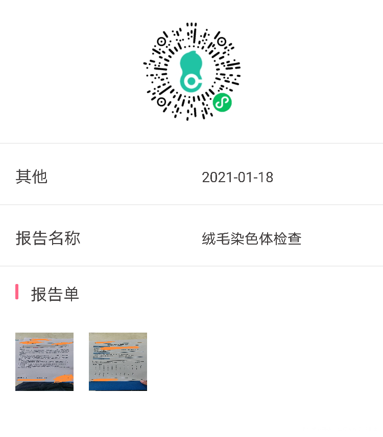2020年2月自然流产一次2021年1月胎停