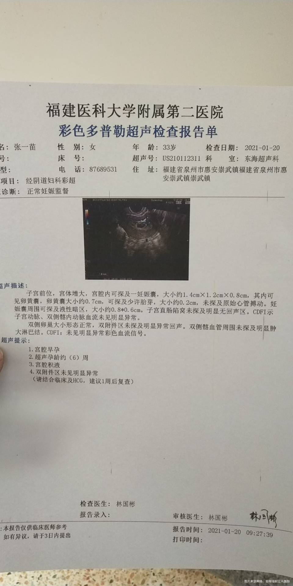 试管冻囊胚移值怀孕后阴超检查6周多未发现胎芽