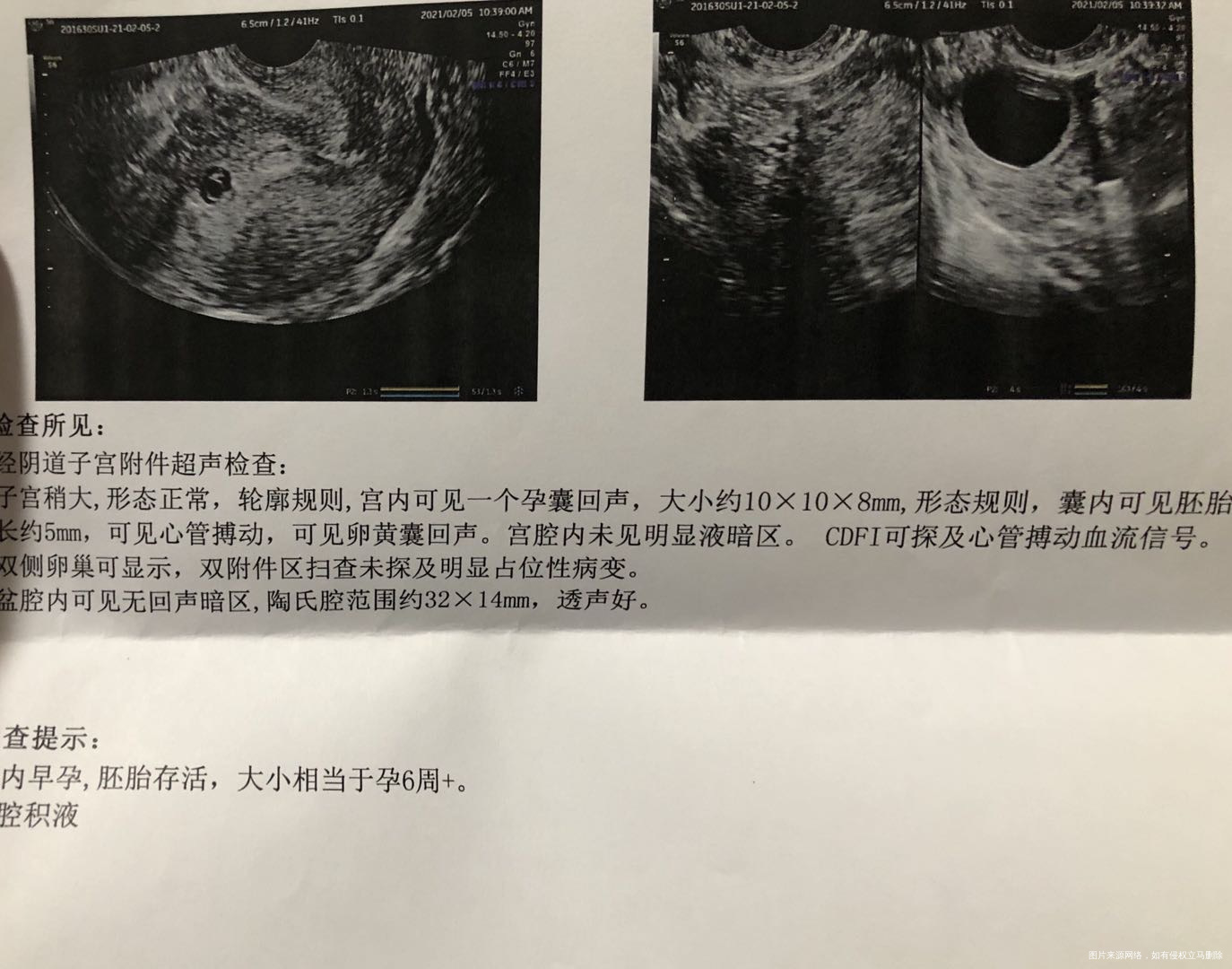 末次月经1216号一号做的人授B超显示有孕囊
