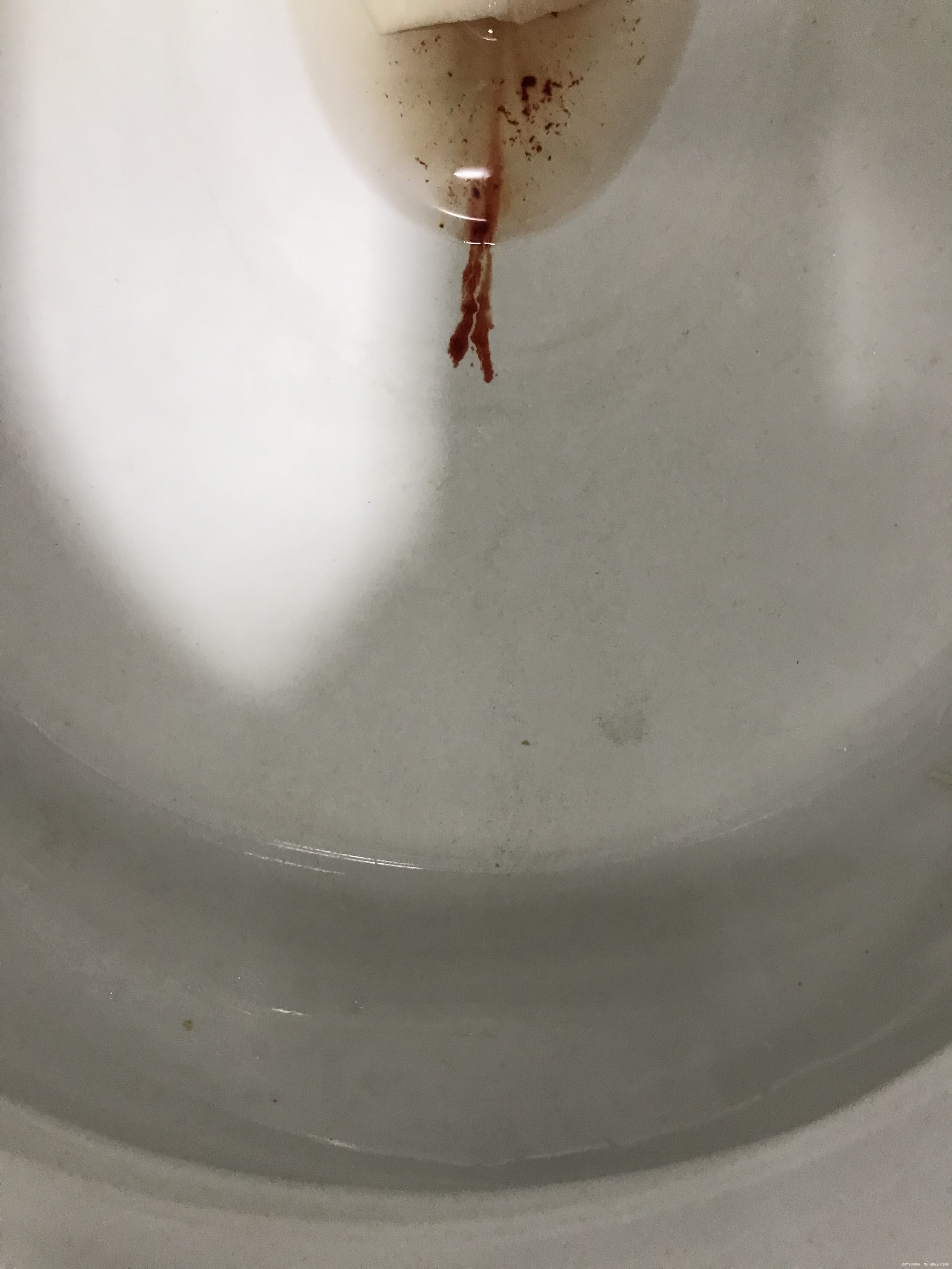 孕38+在医院取分泌物检查取完分泌物后当天出