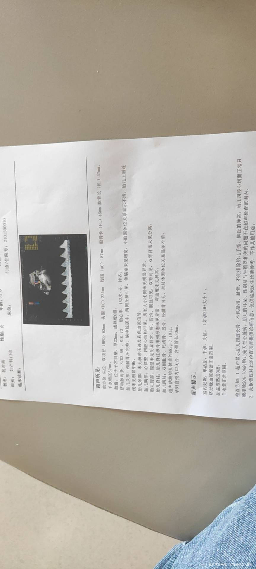 请问我现在这个孕周胎盘厚度才23mm属于正常