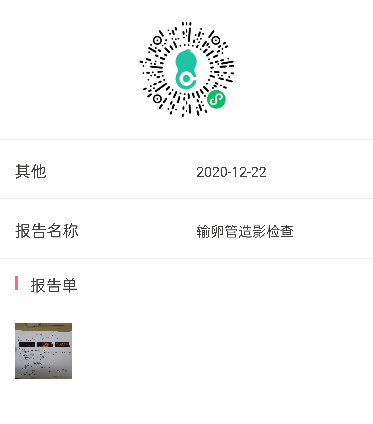 右侧输卵管稍纤细通而不畅可以用右侧输卵管进行