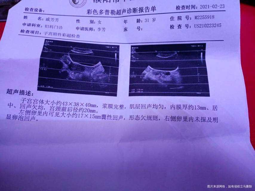 医生您好我现在在监测卵泡备孕想请您看下阴超单