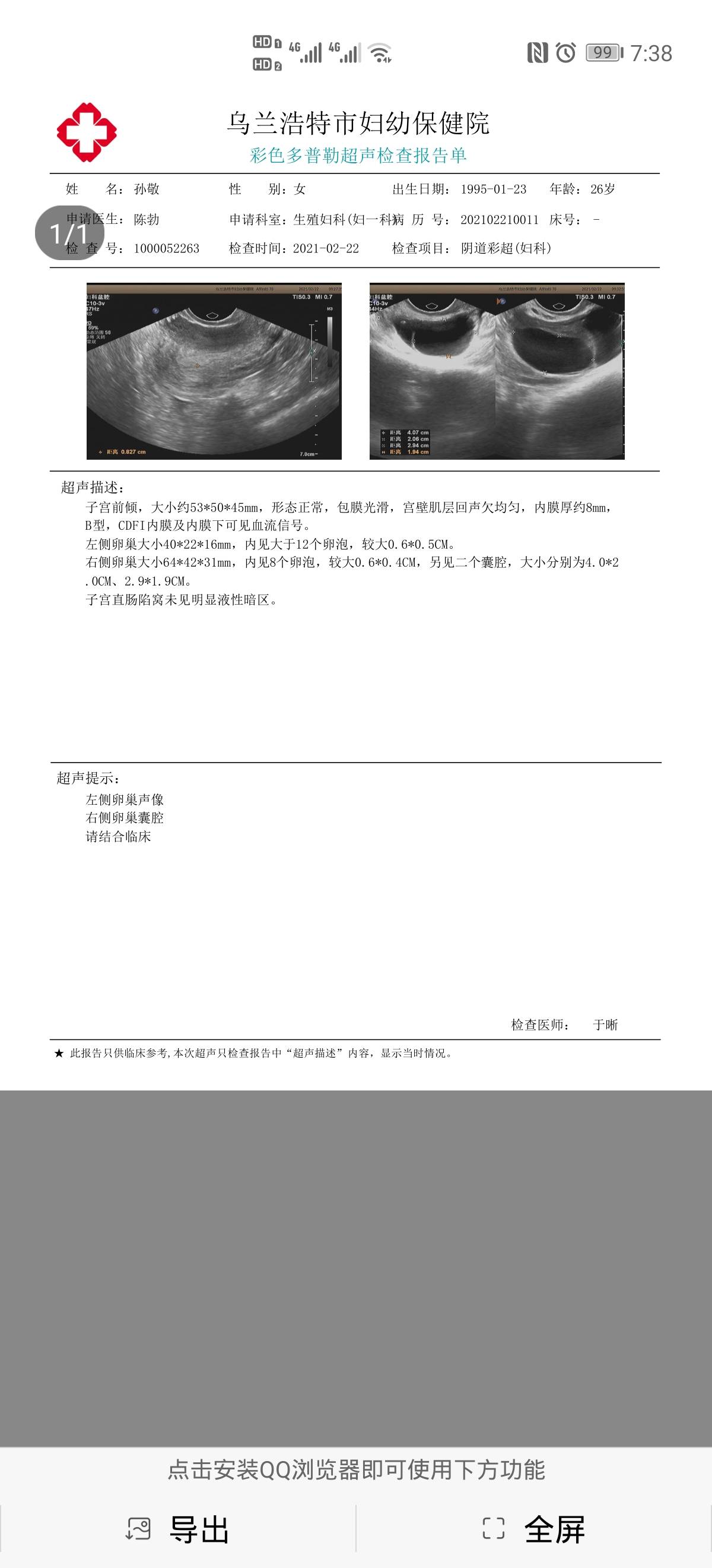 不排卵打了排卵针没破应该还检查什么