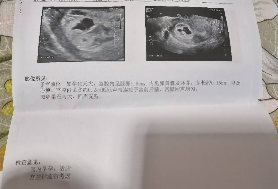 医生你好怀孕早期发现有宫腔粘连带怎么办还可以