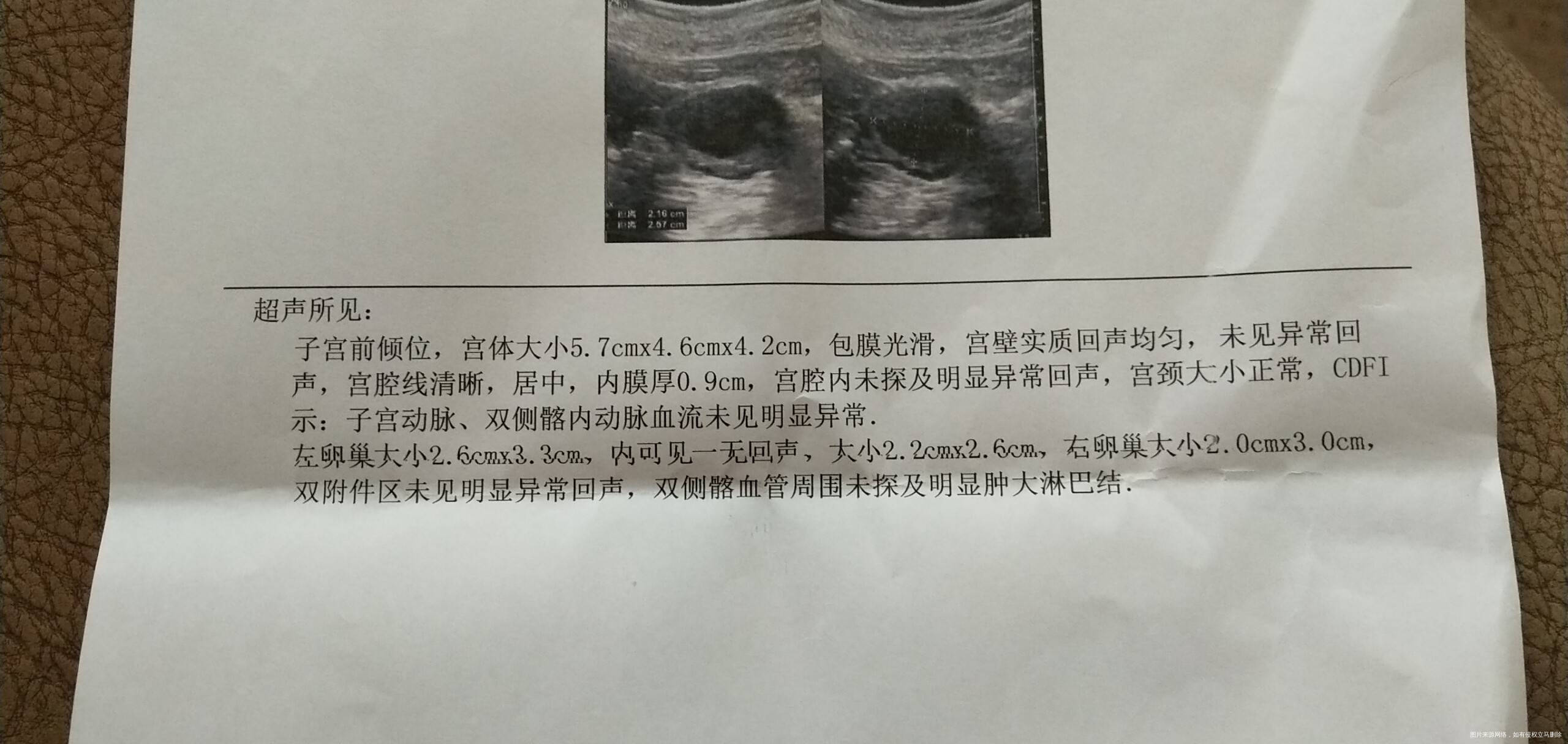 一切检查都正常二胎一直是没怀上昨天和今天都有