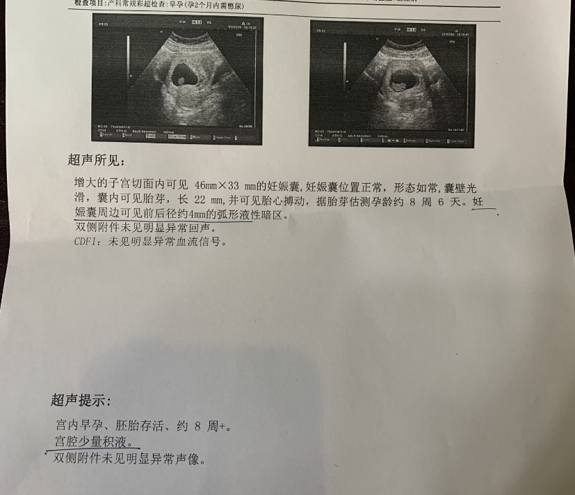 孕8+6B超单显示妊娠囊46×33mm胎芽2