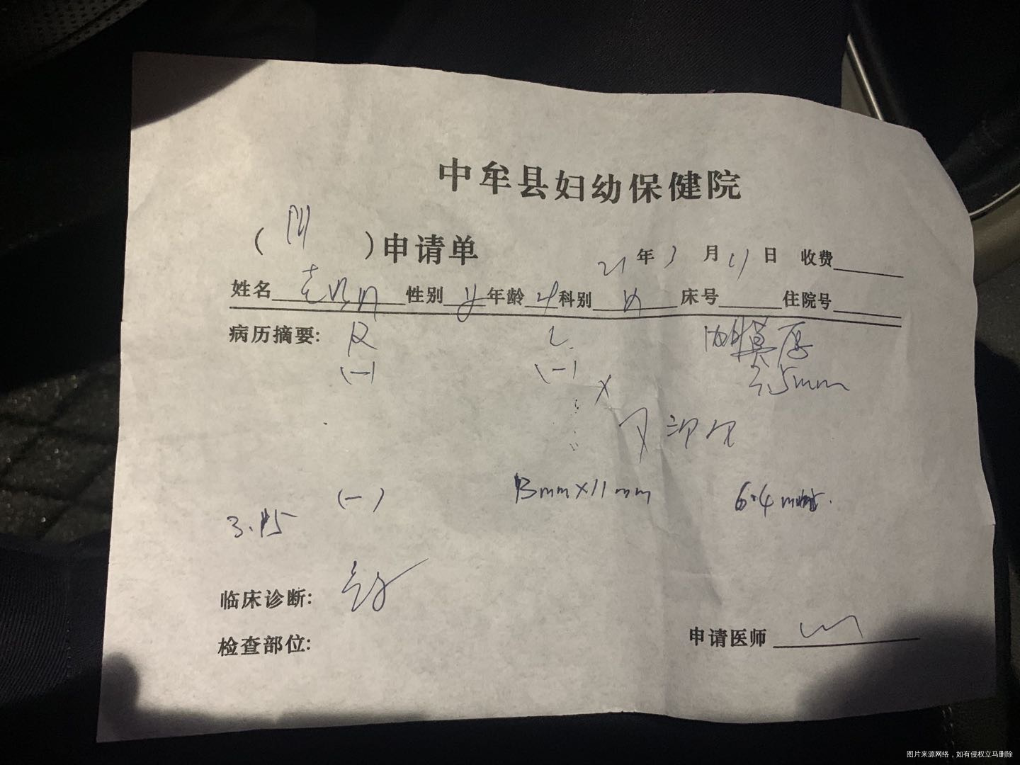 这种卵泡发育情况是发育成熟了吗昨天打了HCG