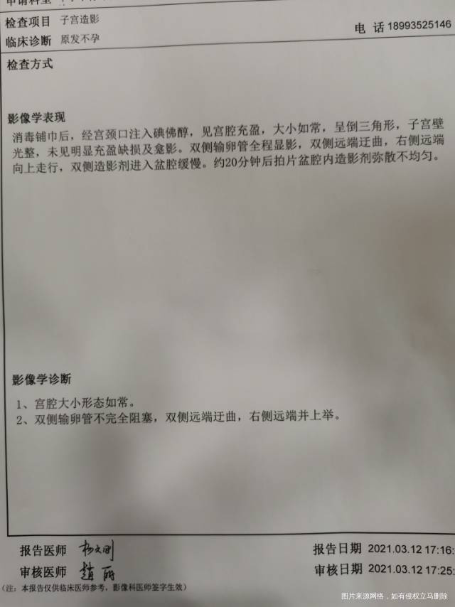 备孕两年没有怀孕在这之前做过人流没怀过孕没做