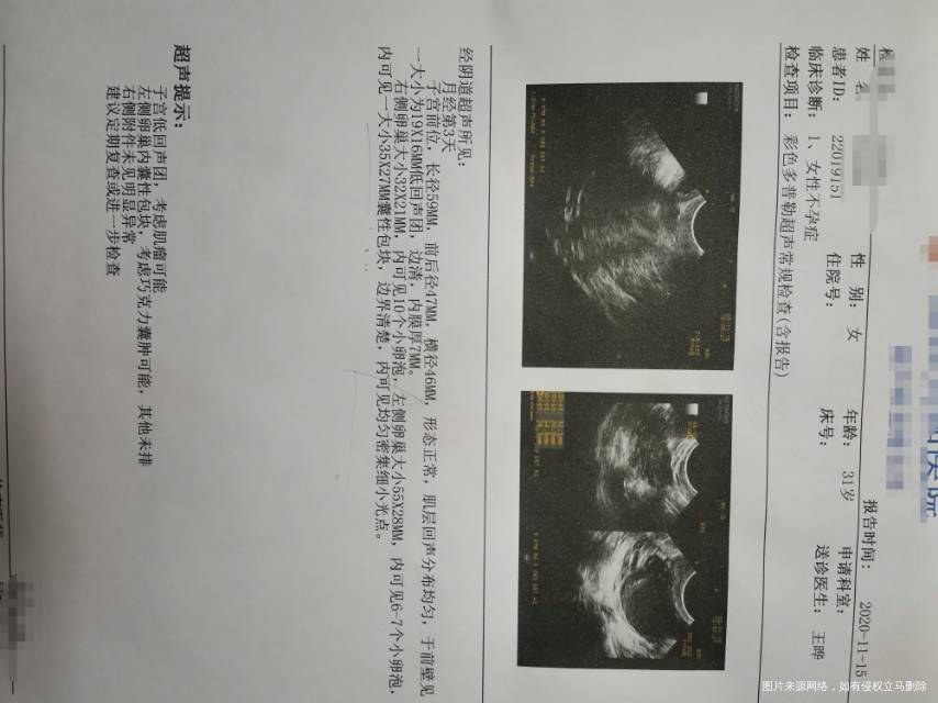 医生您好我目前备孕七个月左右一直没怀上B超检