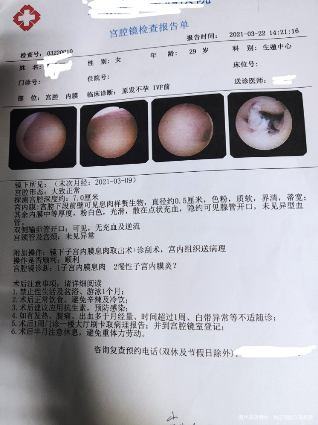 我是取卵促时子宫内有团块取卵后没有移植做的宫