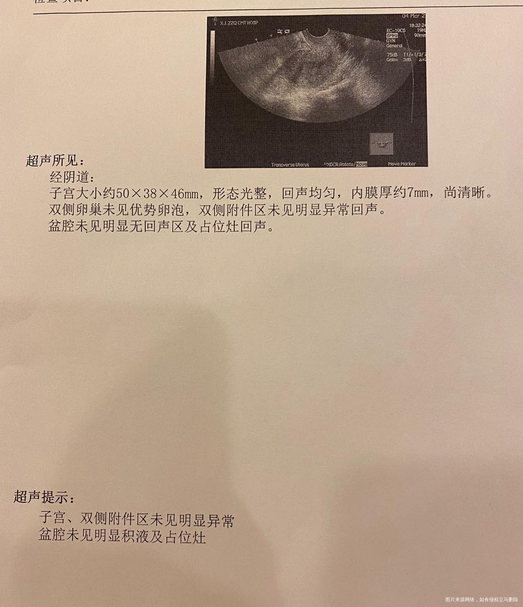 目前备孕状态目前备孕两个月过去了正在来月经月