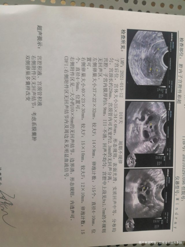 医生能帮我看下b超单有什么问题吗备孕第三个月