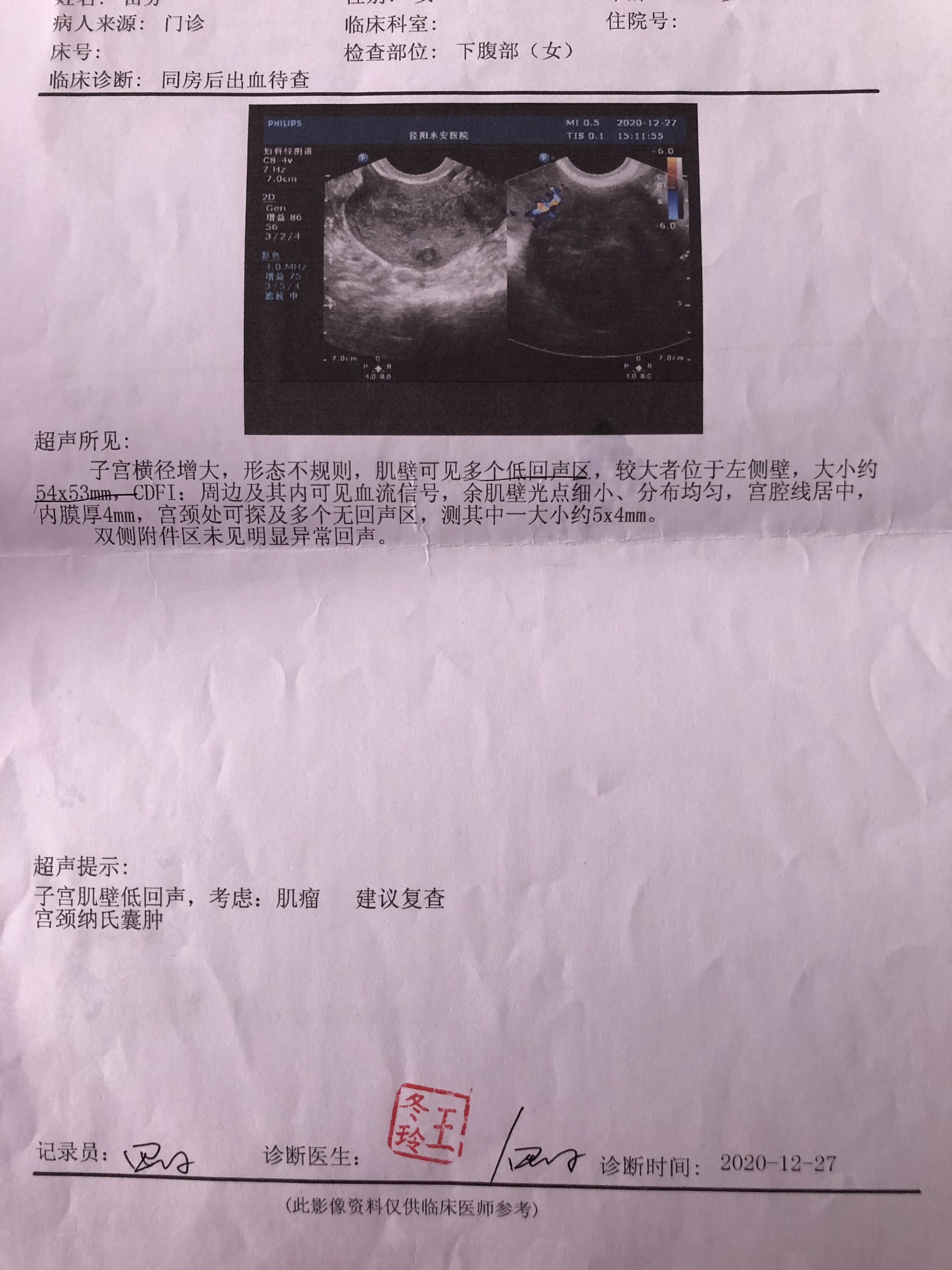 你好大夫之前检查一直有子宫肌瘤一直处于备孕期