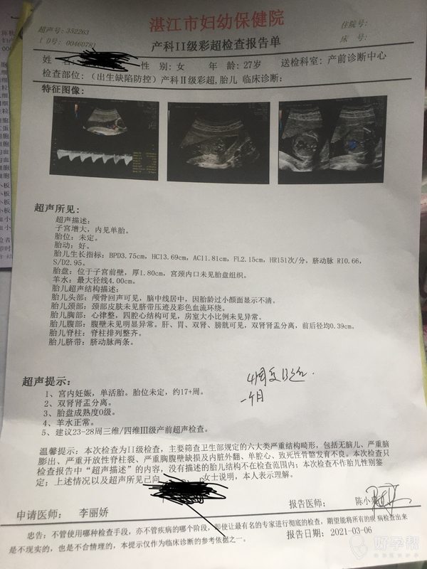 济源市妇幼保健院没有问题的  多喝水  定时产检2021-03-06 16:45