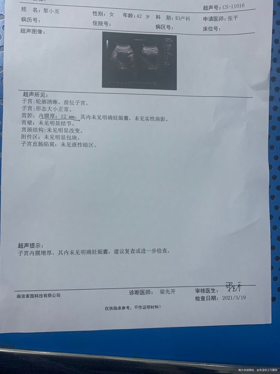 2月5号最后一次月经到目前没有来请问我这是什