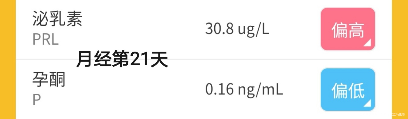 瘦多囊月经第二天检查泌乳素27第21天泌乳素