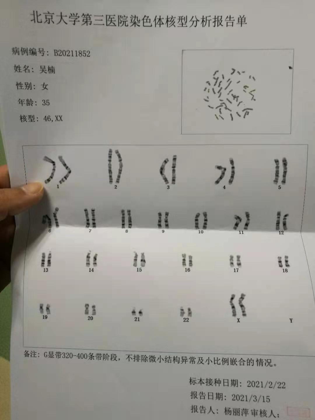 19年孕五周自然流产现备孕5个月检查核型染色