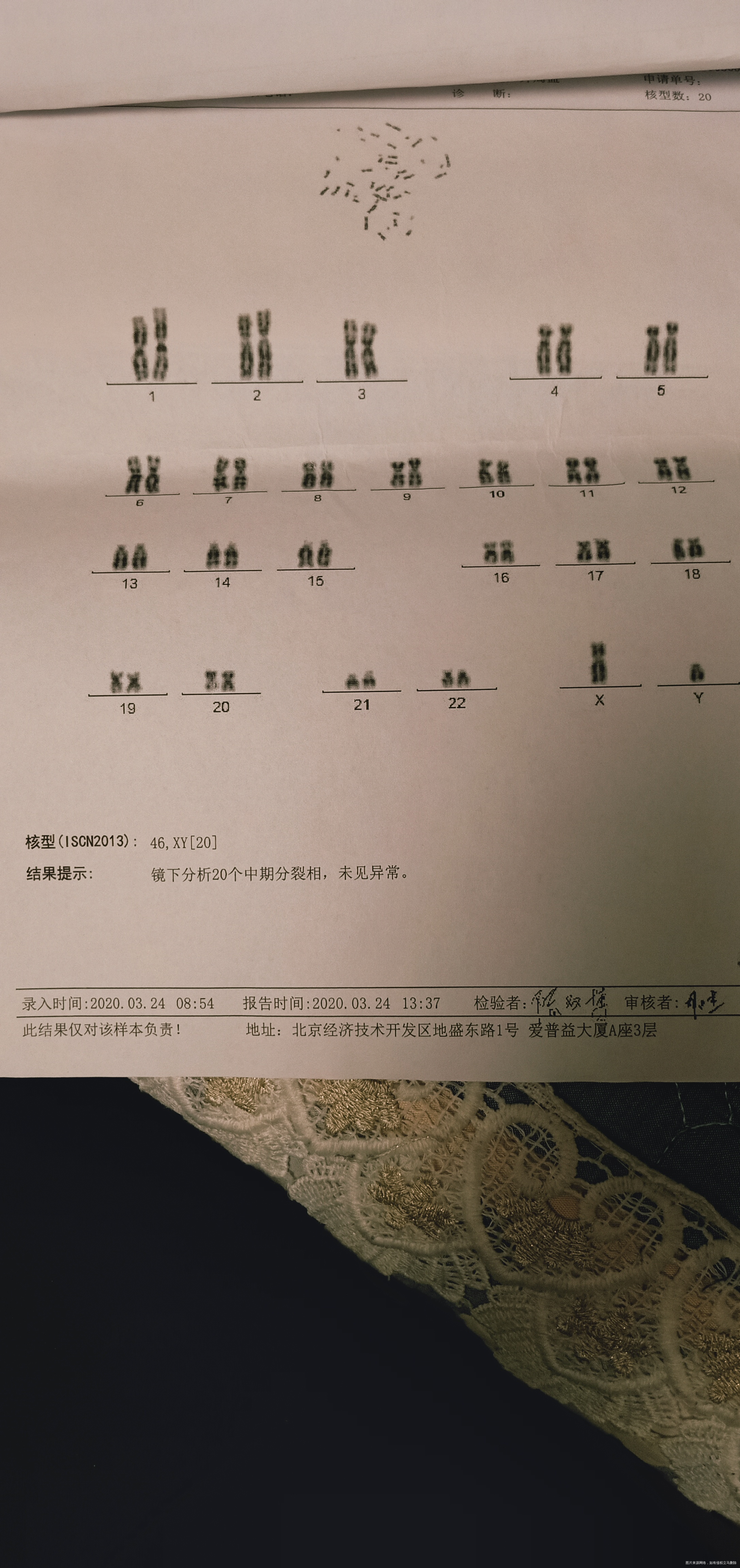 我胎停三次最后一次做了胚胎染色体十六号三体这