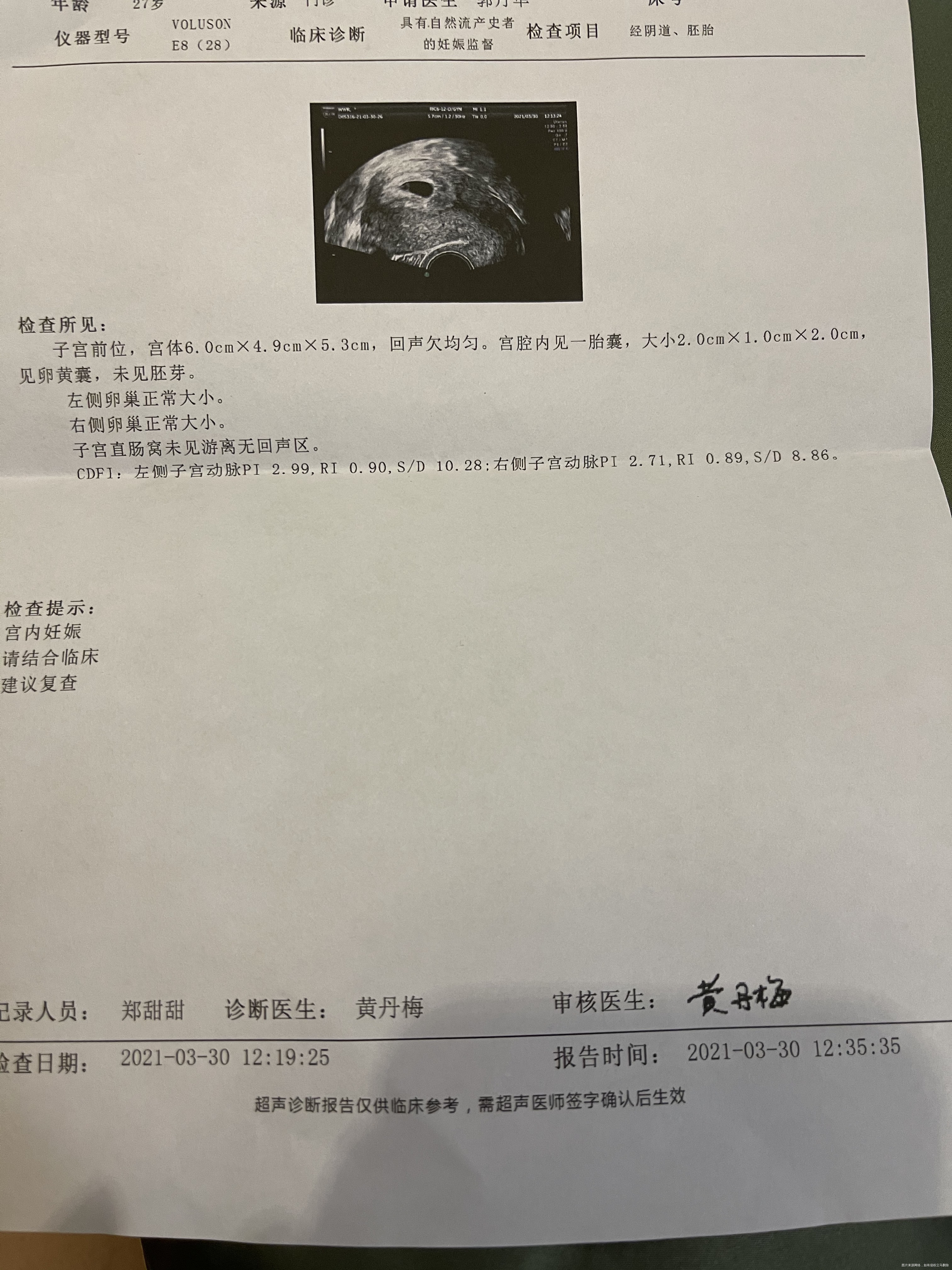 医生你好去年有过一次8周胎停自然流产史末次月