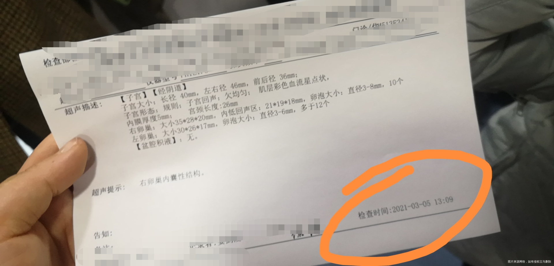 多囊第二次促排5号做了B超显示低回声区211