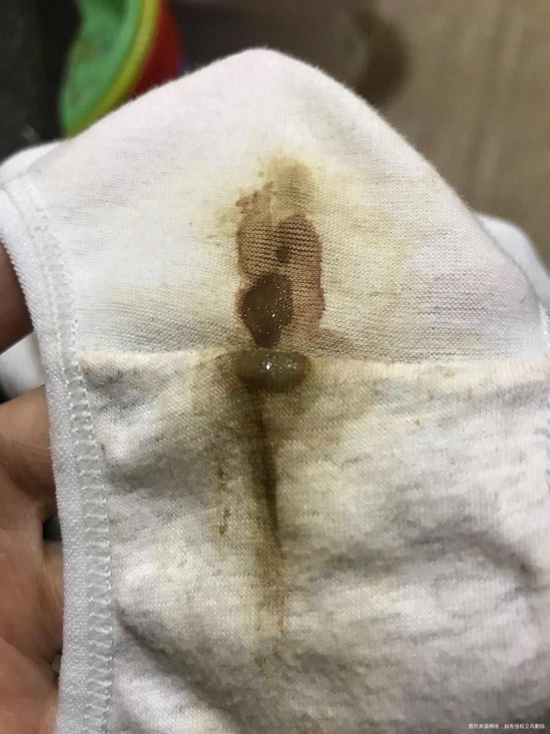 双胎孕12+4NT一切正常回家后两天开始有点