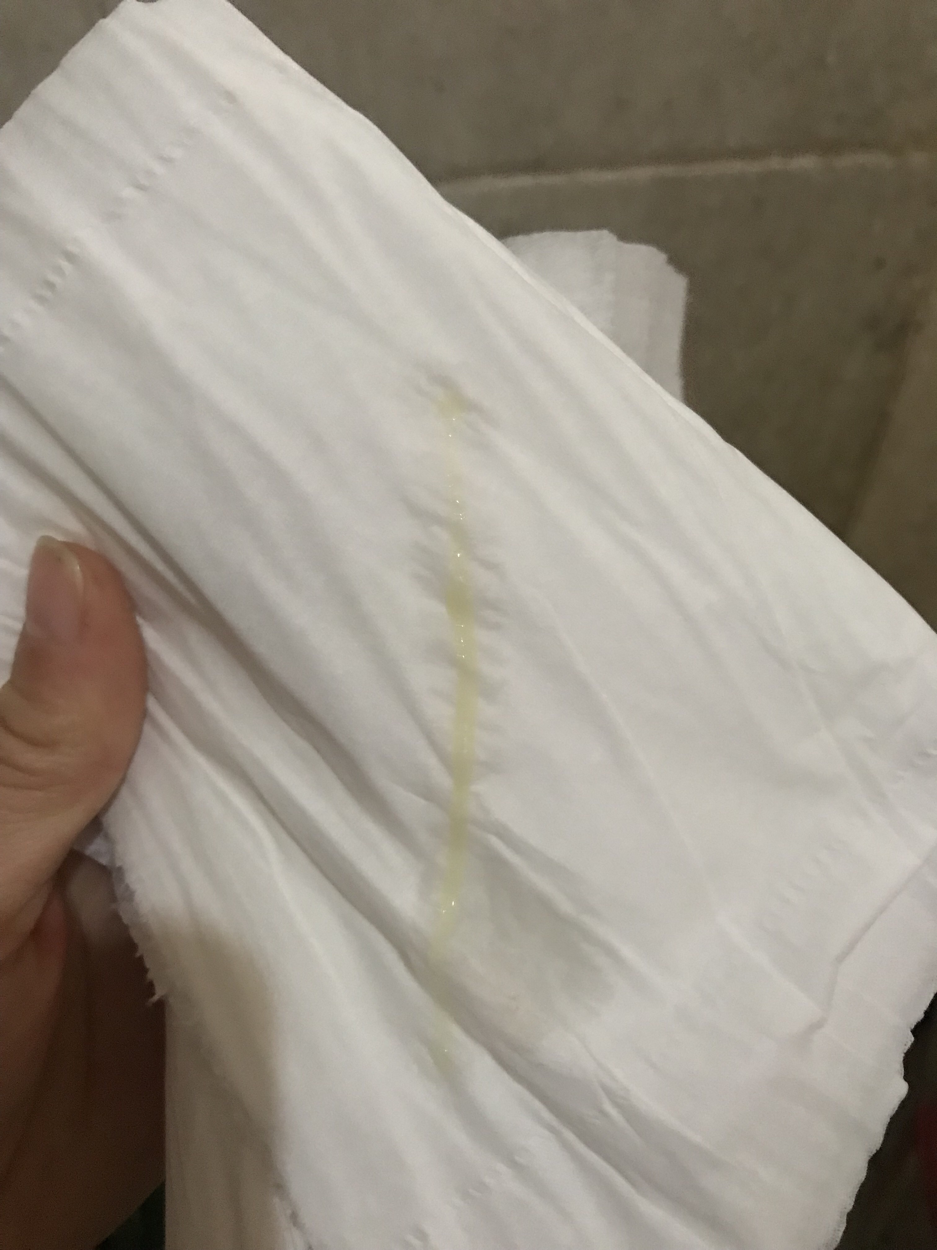 医生怀孕3个月了但是一直流这种分泌物有什么问