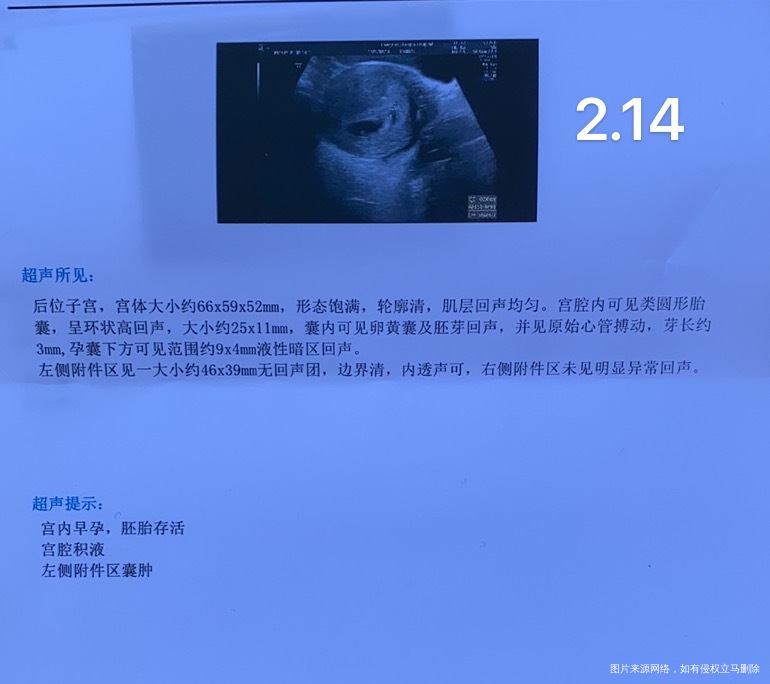 你好医生末次月经11~17现在软件显示九周了