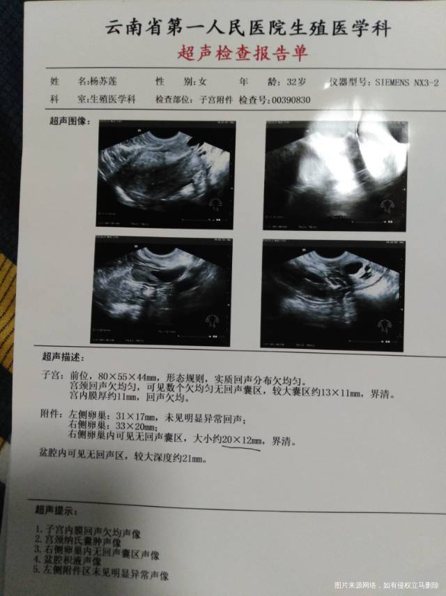 1月19号吃克龄蒙来了月经来促排雌激素高了进