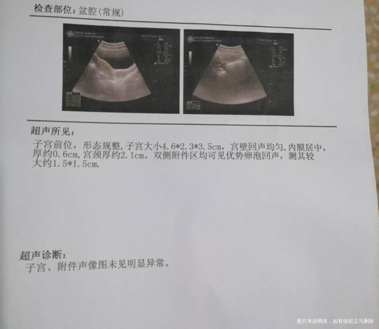 医生1号晚上来的月经这是13号的监测排卵单子