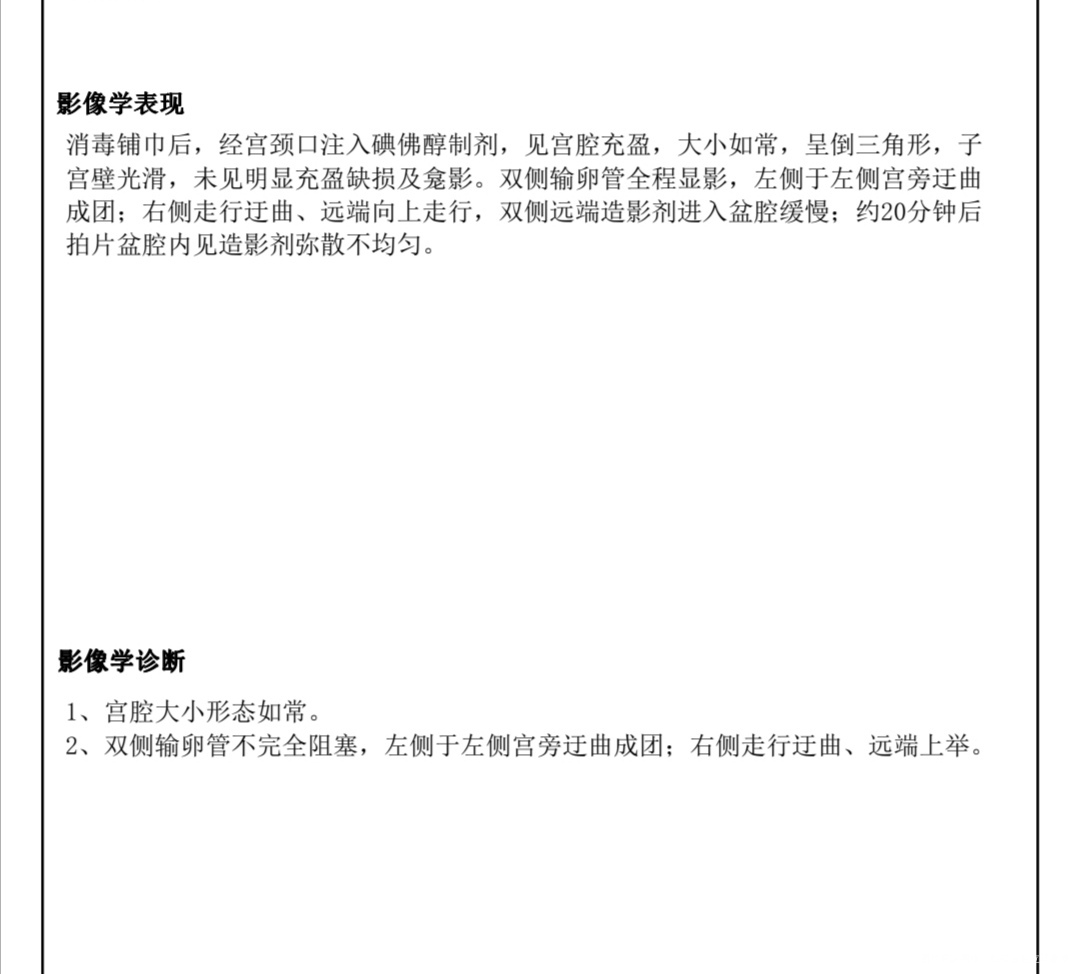 右侧迂曲成团远端上举