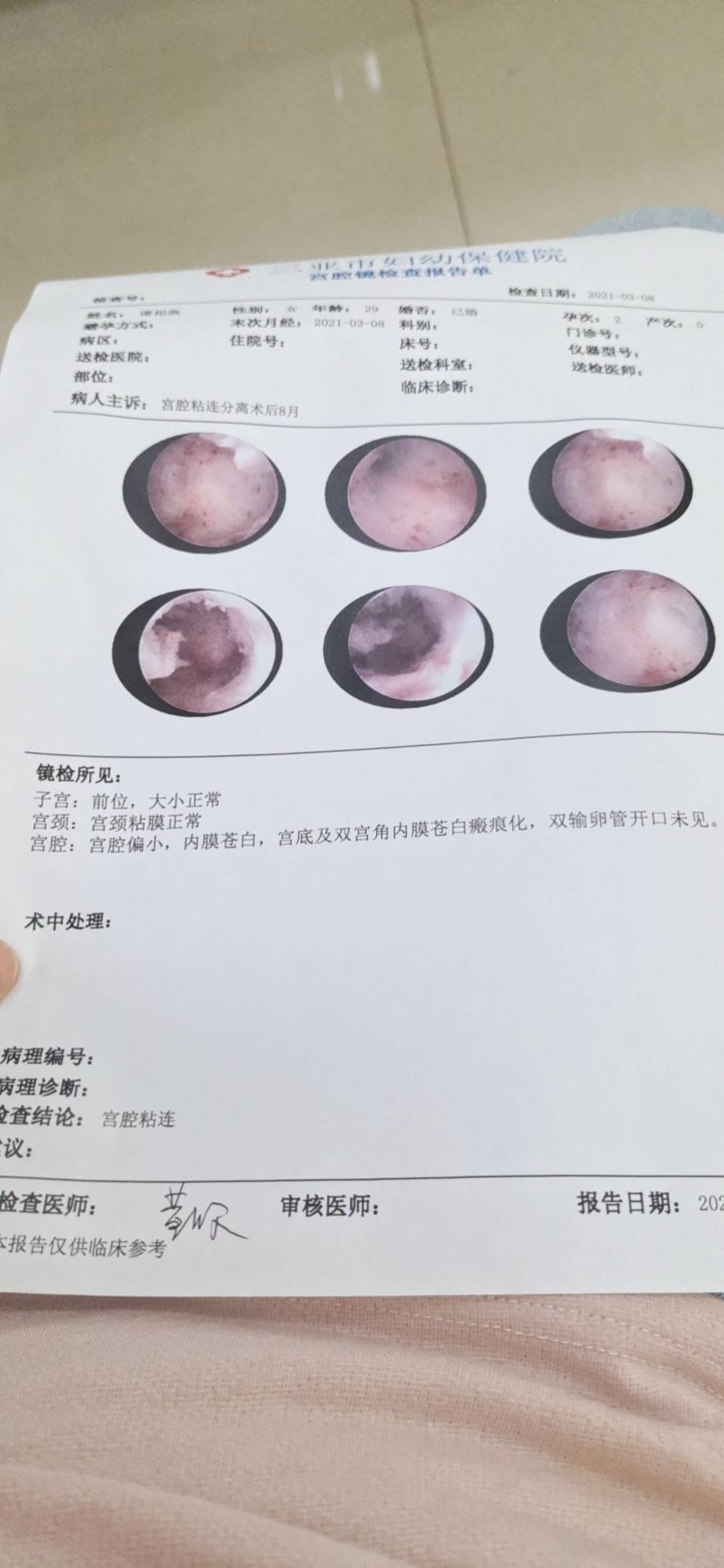 术后半年又复粘了帮我看看这个还有希望吗