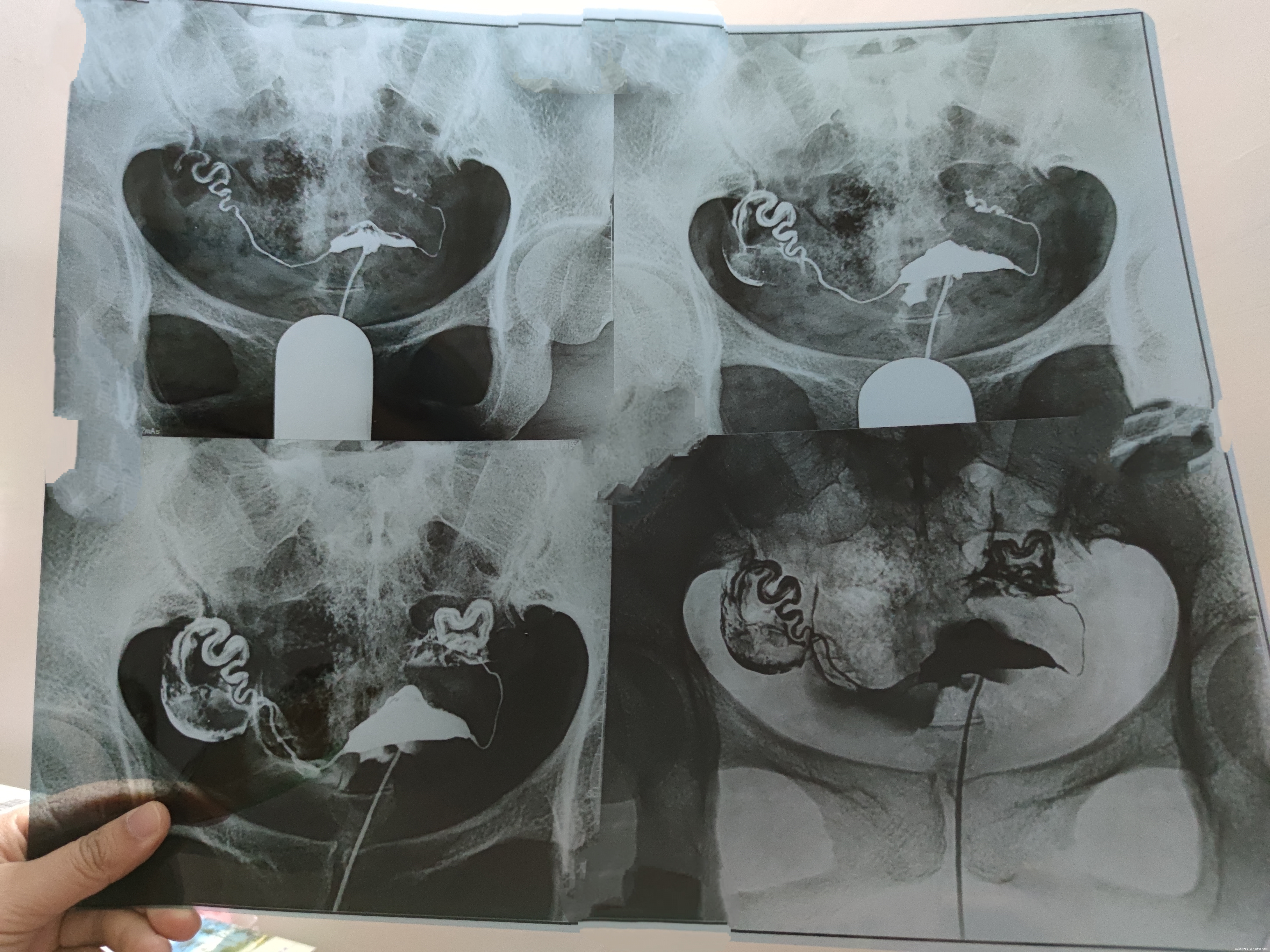 能否帮我看看造影片子具体问题是什么