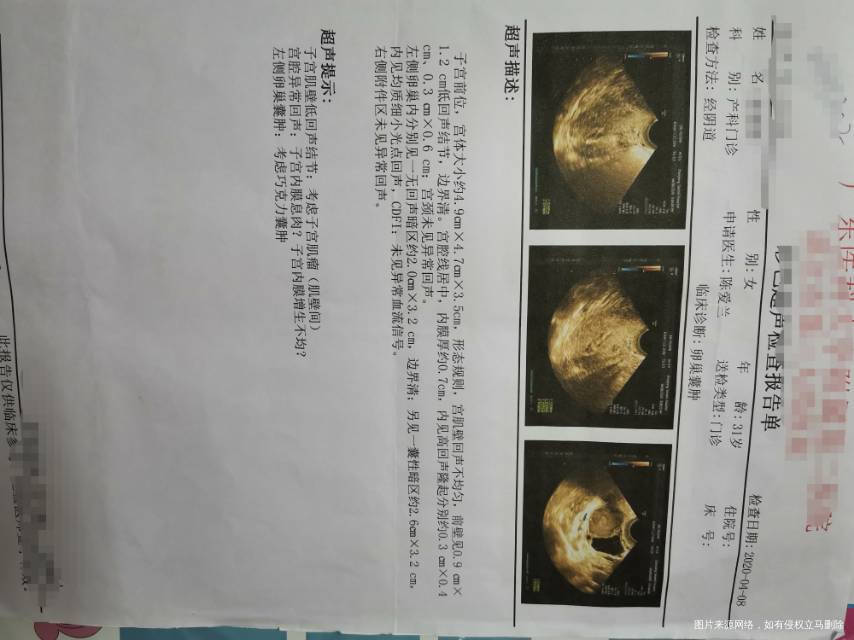 医生您好我目前备孕七个月左右一直没怀上B超检