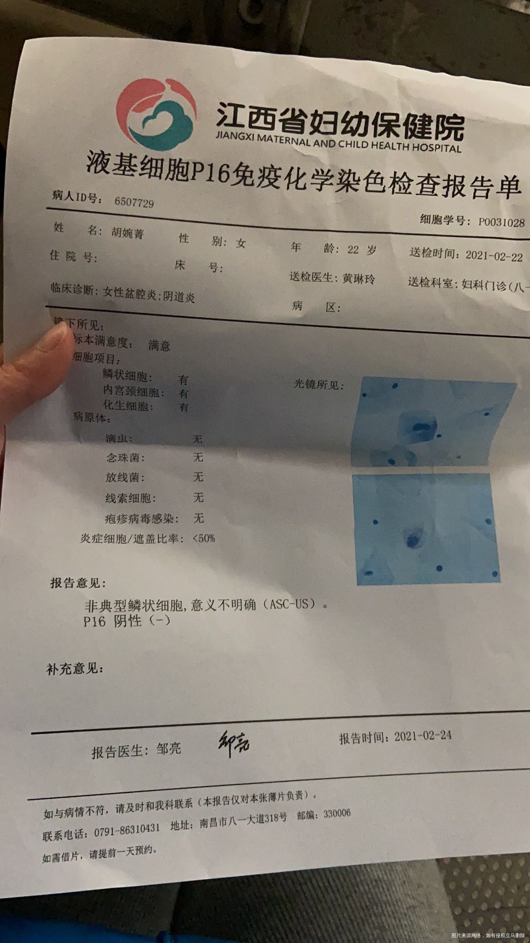 盆腔炎+解尿支原体感染+hpv药流加清宫以后