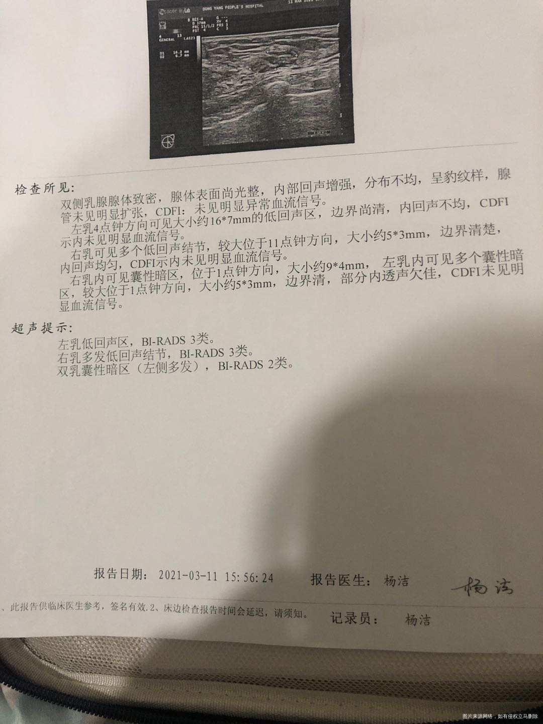 我是做试管婴儿刚开始检查查出乳腺结节有一个最